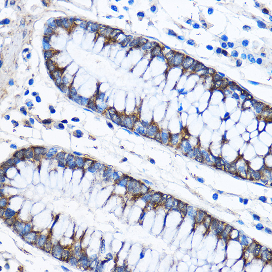 Anti-CAPZA2 Antibody (CAB2054)