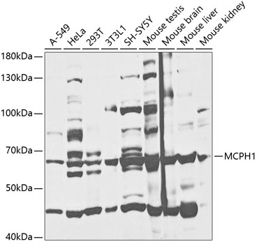 Anti-MCPH1 Antibody (CAB5472)