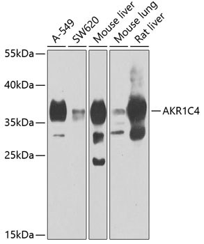 Anti-AKR1C4 Antibody (CAB7430)