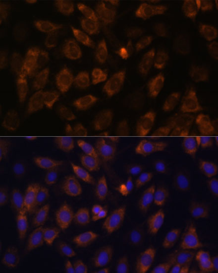 Anti-MT-ND4L Antibody (CAB17971)