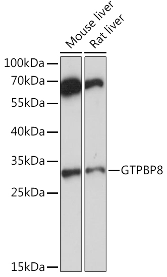 Anti-GTPBP8 Antibody (CAB16189)