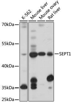 Anti-SEPT1 Antibody (CAB17471)