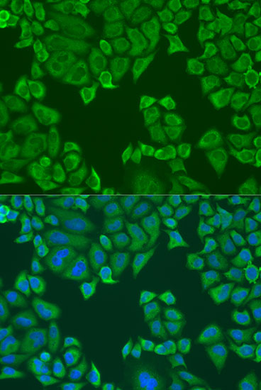 Anti-PABPC4 Antibody (CAB5948)