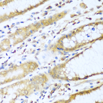 Anti-UBE2L3 Antibody (CAB4175)