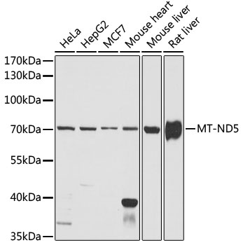 Anti-MT-ND5 Antibody (CAB17972)