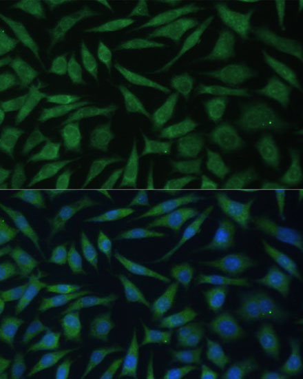 Anti-REXO2 Antibody (CAB15808)