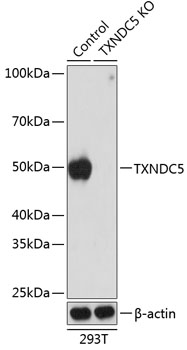 Anti-TXNDC5 Antibody [KO Validated] (CAB19930)