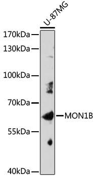 Anti-MON1B Antibody (CAB17640)