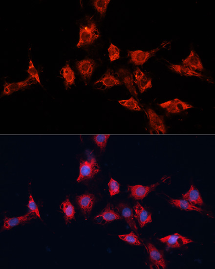 Anti-ADAM11 Antibody (CAB14249)