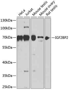 Anti-IGF2BP2 Antibody (CAB14103)