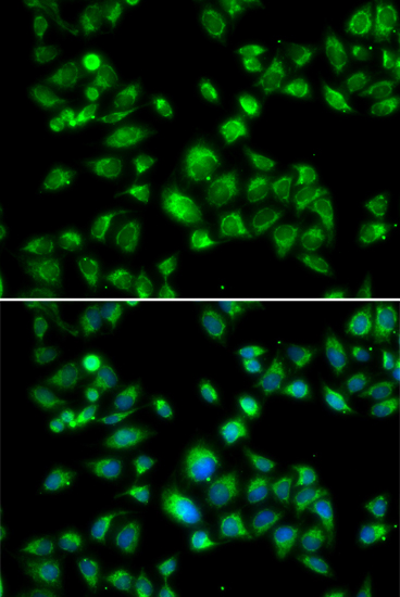 Anti-MBTPS1 Antibody (CAB13379)