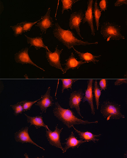 Anti-Tau Antibody (CAB0002)