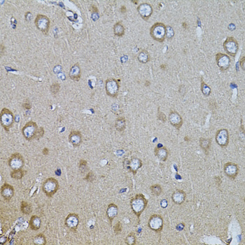 Anti-Integrin beta-8 Polyclonal Antibody (CAB8433)