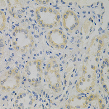 Anti-STMN1 Antibody (CAB14018)