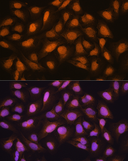 Anti-SKP2 Antibody (CAB7728)