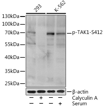 Anti-Phospho-MAP3K7-S412 Antibody (CABP0071)