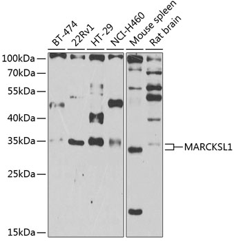 Anti-MARCKSL1 Antibody (CAB7132)