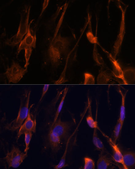 Anti-BFAR Polyclonal Antibody (CAB8308)