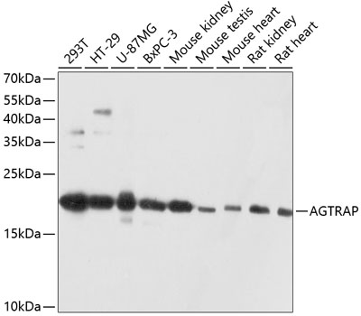 Anti-AGTRAP Antibody (CAB12178)