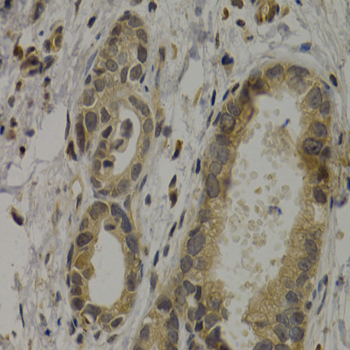 Anti-MAGEA1 Antibody (CAB5470)