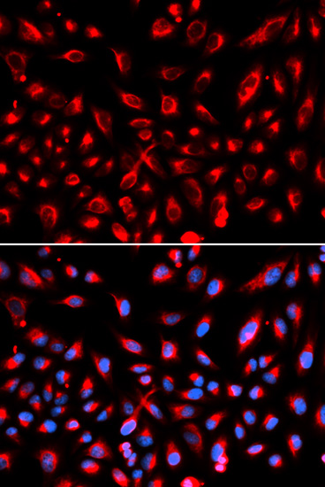 Anti-CLDN11 Antibody (CAB2593)