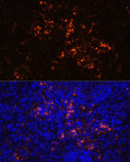 Anti-CD70 Antibody (CAB16698)