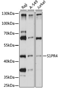 Anti-S1PR4 Antibody (CAB15117)