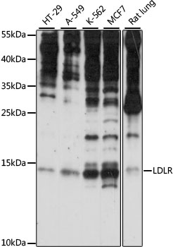 Anti-SNRNP25 Antibody (CAB15511)