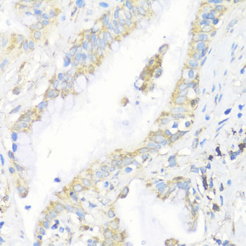 Anti-EIF3J Polyclonal Antibody (CAB8637)