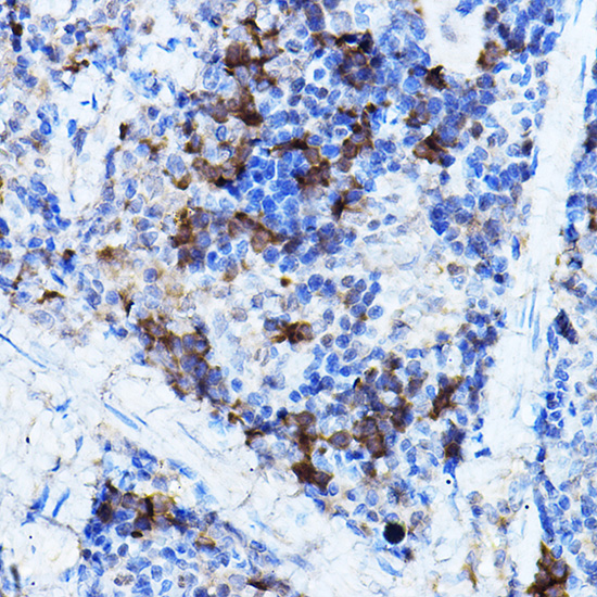 Anti-ERK2 Antibody [KO Validated] (CAB11186)