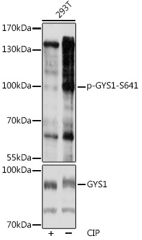 Anti-Phospho-GYS1-S641 pAb (CABP0877)