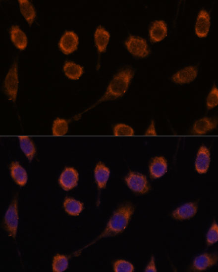 Anti-CCT6B Antibody (CAB14615)