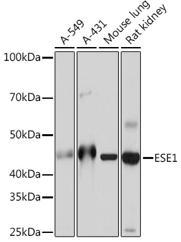 Anti-ESE1 Antibody (CAB5236)