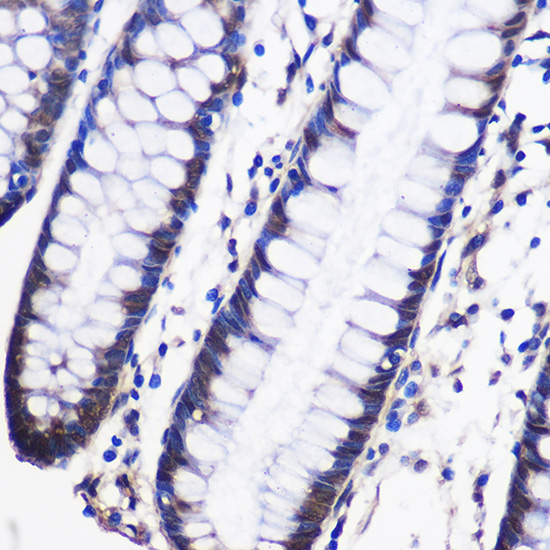 Anti-CELF1 Antibody (CAB5958)