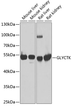 Anti-GLYCTK Antibody (CAB7852)