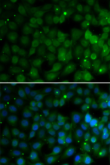 Anti-HPD Antibody (CAB6505)