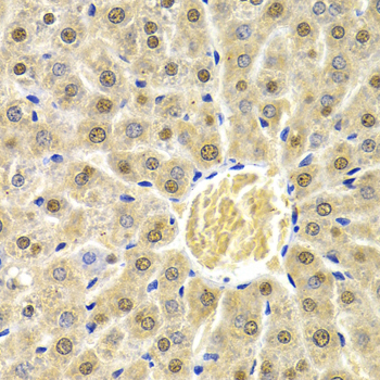 Anti-RAD9A Antibody (CAB1890)