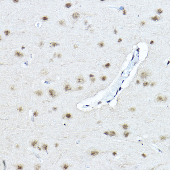 Anti-Twist Antibody (CAB3237)