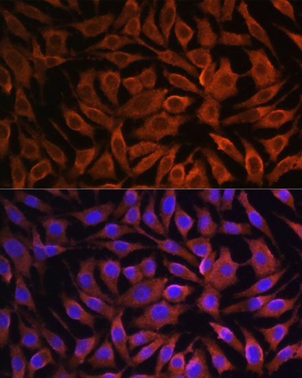 Anti-GIT1 Antibody [KO Validated] (CAB15437)