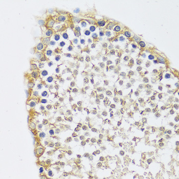 Anti-C12orf10 Antibody (CAB17198)