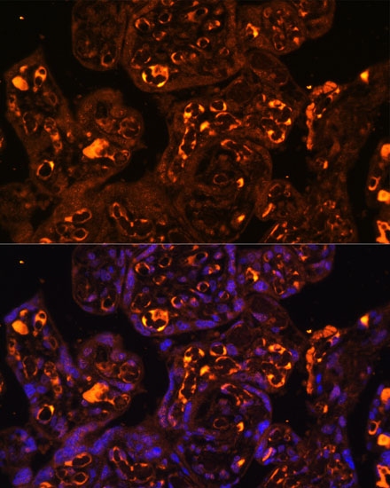 Anti-LAIR2 Antibody (CAB14376)