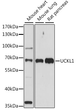 Anti-UCKL1 Antibody (CAB15851)