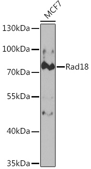 Anti-Rad18 Antibody (CAB5380)