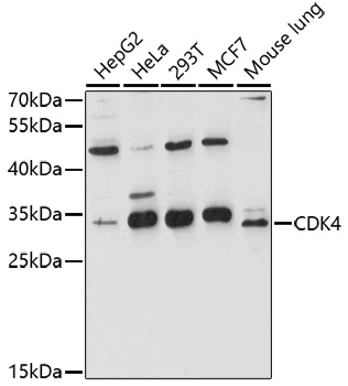 Anti-CDK4 Antibody (CAB0366)