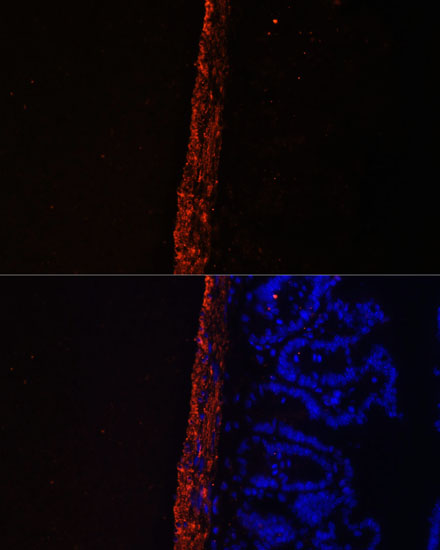 Anti-MYL9 Antibody (CAB3039)