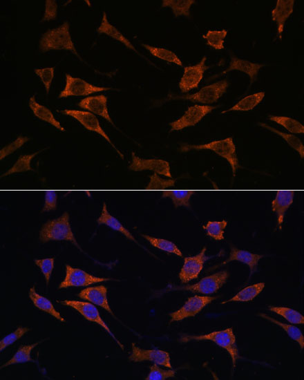 Anti-RPS17 Antibody (CAB16426)