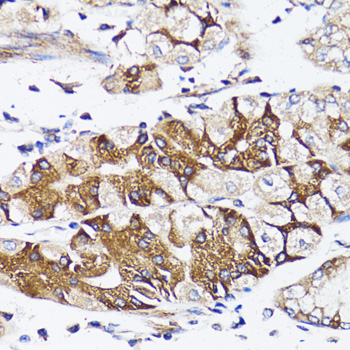 Anti-BCAP29 Antibody (CAB6335)