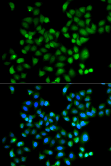 Anti-ZSCAN26 Antibody (CAB7571)