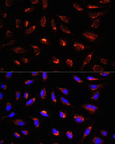 Anti-GCSH Antibody (CAB13695)