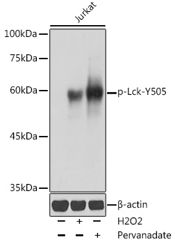 Anti-Phospho-Lck-Y505 Antibody (CABP0285)